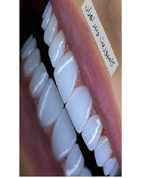 بهترین مارک ونیر در تهران بهترین مارک ونیر در تهران